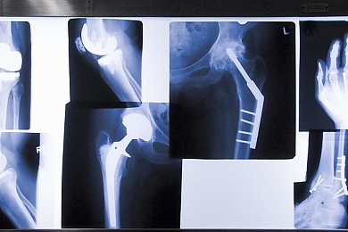 3d强斗破苍穹美杜莎人物游戏,3D游戏新宠，美杜莎荣耀再现
